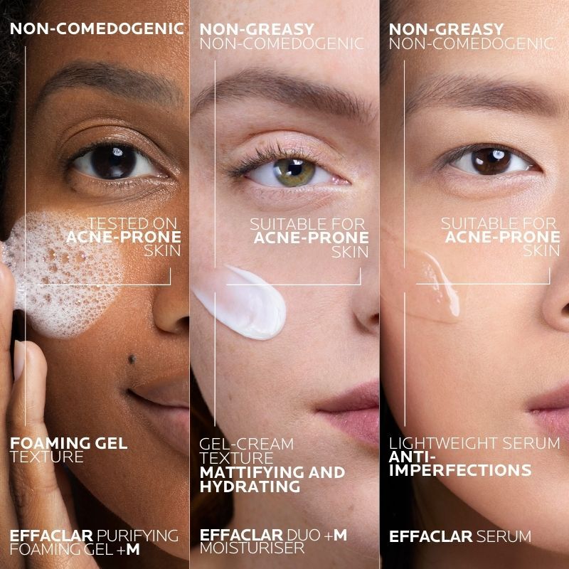 Anti-Blackhead Treatment Set
