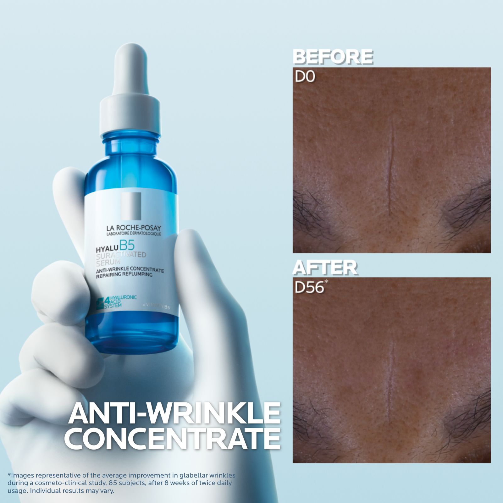 Hyalu B5 Suractivated Hyaluronic Acid Serum