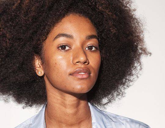 NIACINDAMIDE AND HYPERPIGMENATION