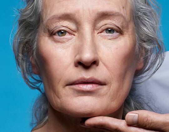 WHAT ARE WRINKLES ON FACE? CAUSES & TIPS