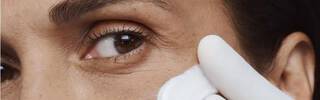 crows feet
