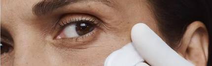 crows feet
