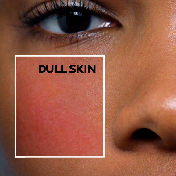 dull-skin