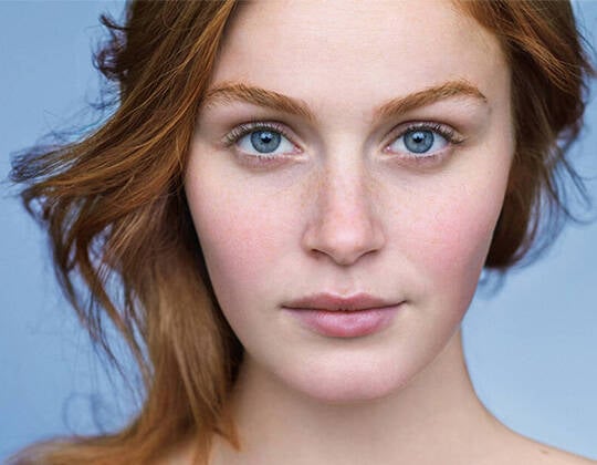 what-causes-facial-redness