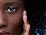 sensitive skin 