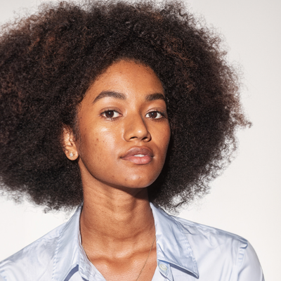 what is hyperpigmentation