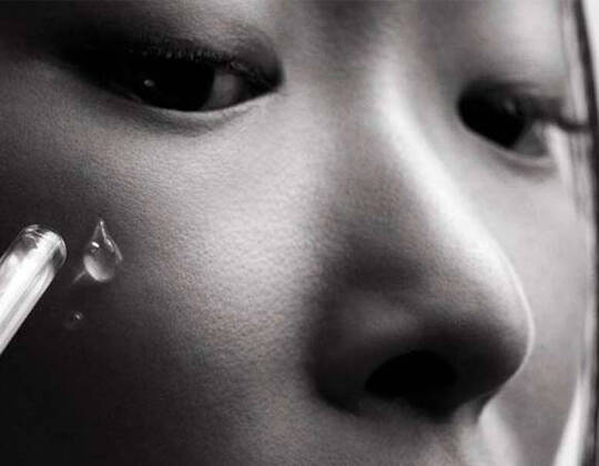 HOW TO CARE FOR ALLERGY-PRONE SKIN