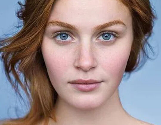 HOW TO MANAGE ROSACEA