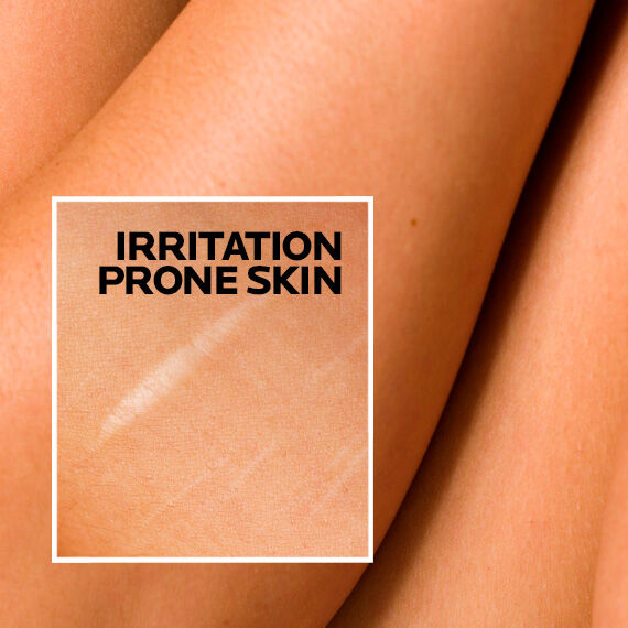 irritation-prone