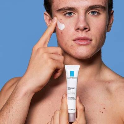Blackhead Treatment