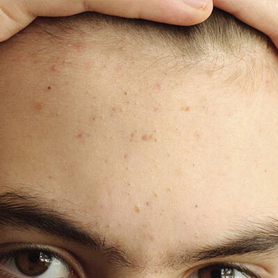 symptoms of skin allergy