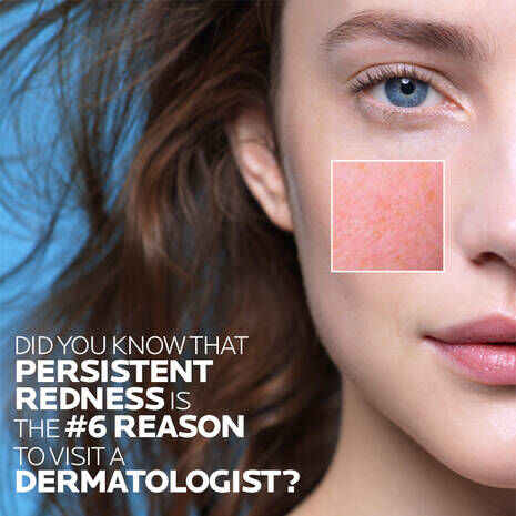 redness and glycerin