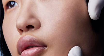 acne around the mouth