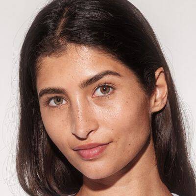 what is hyperpigmentation