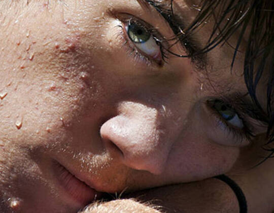 5 Amazing Beauty Benefits Of Vitamin C