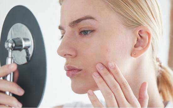 what is skin purging