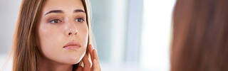 acne breakouts