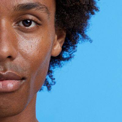 niacinamide