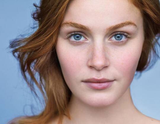 hyaluronic acid for acne