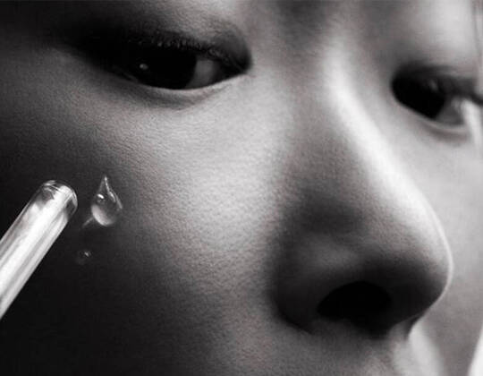 HOW TO CARE FOR ALLERGY-PRONE SKIN