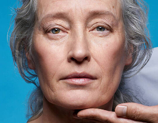 5 Amazing Beauty Benefits Of Vitamin C