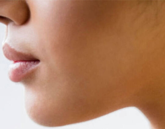 5 Amazing Beauty Benefits Of Vitamin C