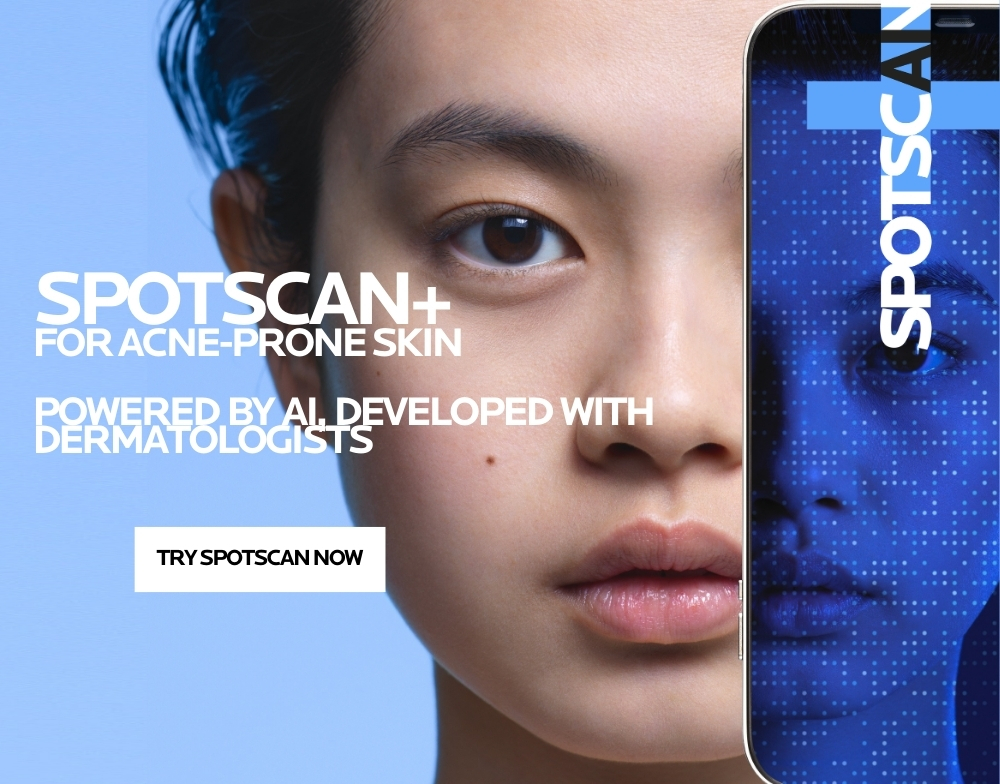 spotscan