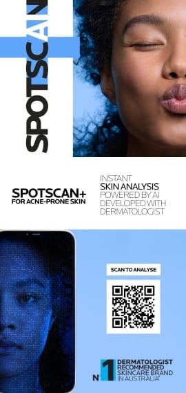 spotscan